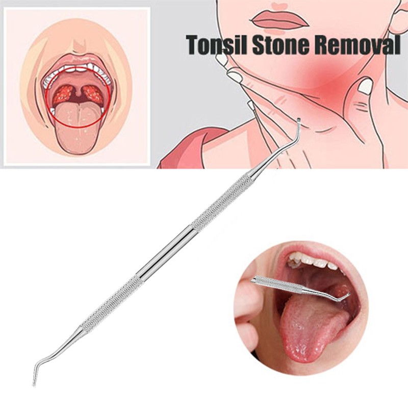 Ear Wax Remover - Outil d'élimination du cérumen pour l'élimination