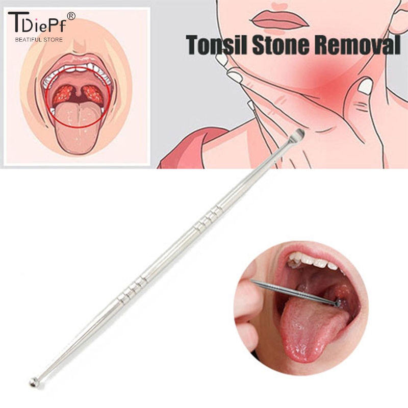 Outil de suppression de pierre - Ear Wax Remover avis et prix